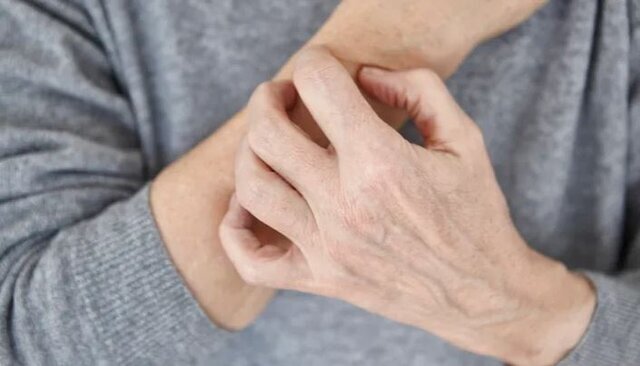 این نشانهها یعنی بیماری پوستی این نشانهها یعنی بیماری پوستی